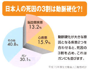 日本人の死因の３割は動脈硬化？